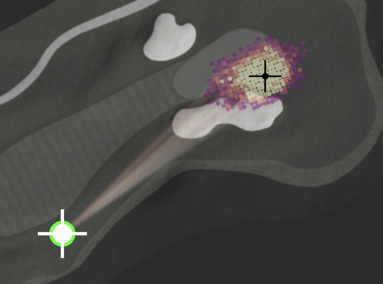 Golf fairway analysis showing shot trajectories and landing zones with AI-powered course intelligence