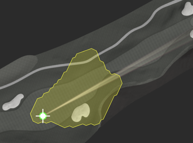 Golf course optimal target zone visualization with probability mapping and strategic landing areas